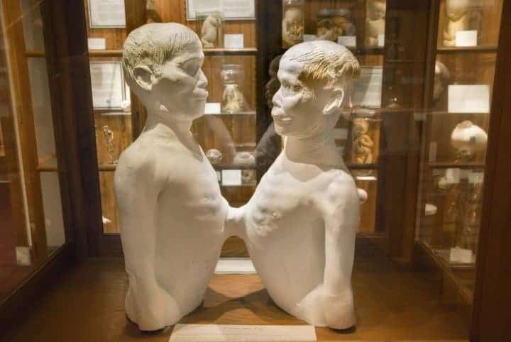 Chang and Eng at the Mutter Museum in Philadelphia